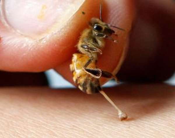 Пчелы и ревматоидный артрит